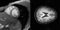 Medical Image Segmentation